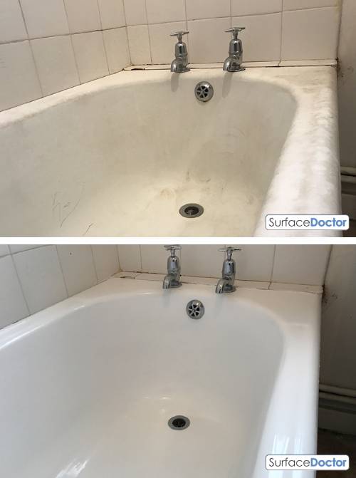 Bath Resurfacing in Barking: Before Image